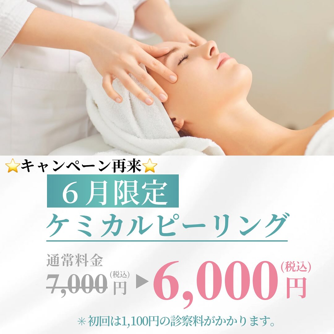 『ケミカルピーリング』キャンペーンのイメージ画像